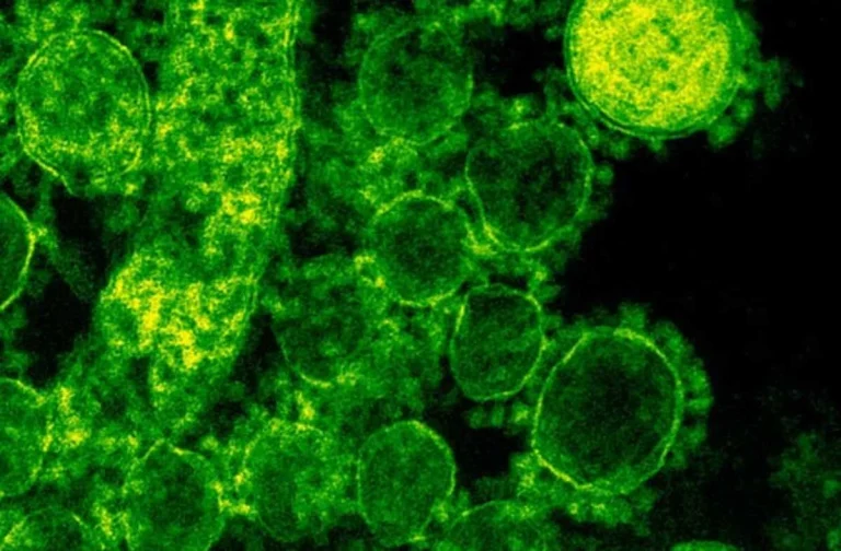 Қытай мен Сингапур ғалымдары жаңа вирусты анықтады