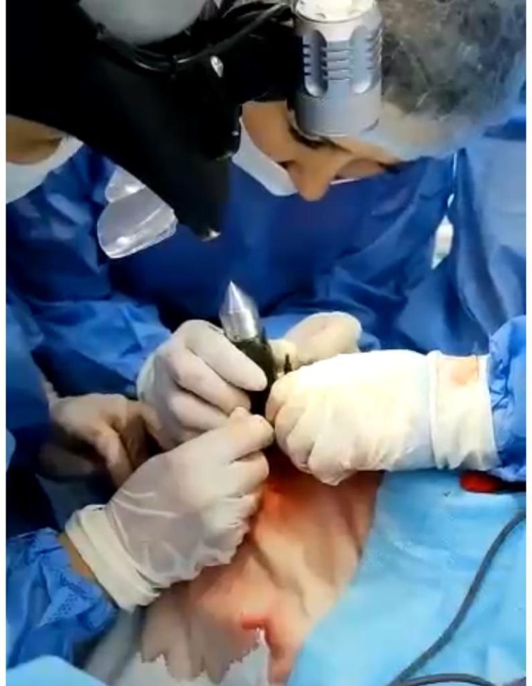 Алматылық офтальмологтар көзіне металл кіріп кеткен ер адамның жанарын сақтап қалды