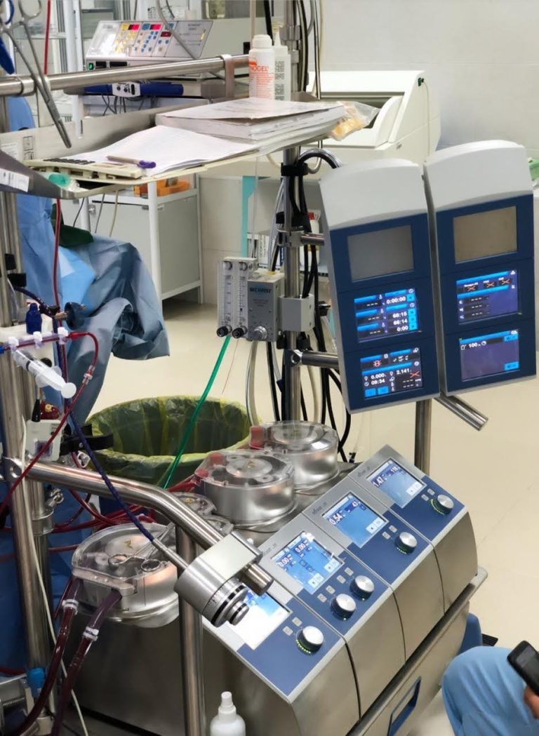 В областном кардиоцентре проведена единовременно по 4 видам операция на открытом сердце