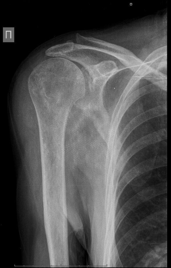 Алматы облысында тірек-қимыл жүйесін емдеудің заманауи тәсілдері енгізілді