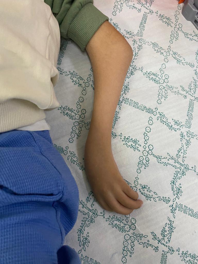 Алматы мен Ярославль дәрігерлері сирек кездесетін аяқ-қол патологиясы бар 8 қазақстандық балаға бірегей ота жасады*