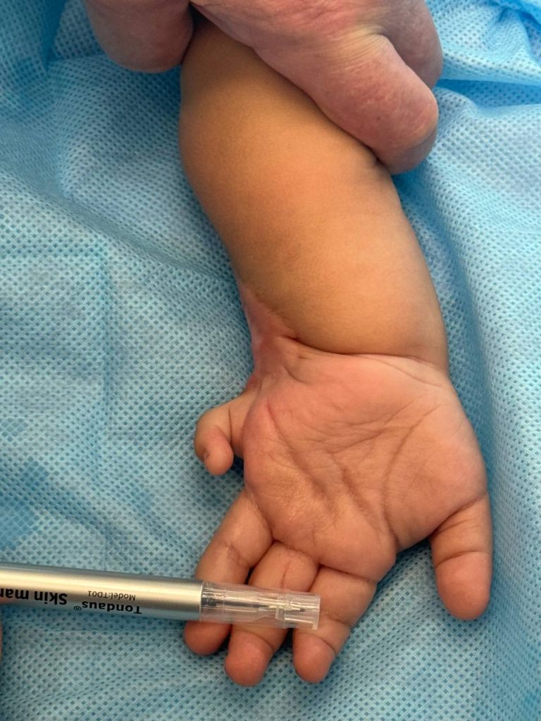 16 казахстанских детей со сложными патологиями прооперированы ведущими травматологами-ортопедами Санкт-Петербурга и Алматы